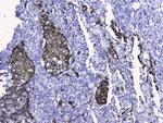 Cytokeratin 19 Antibody in Immunohistochemistry (Paraffin) (IHC (P))