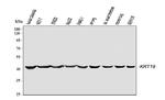 Cytokeratin 19 Antibody in Western Blot (WB)