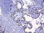 Cytokeratin 19 Antibody in Immunohistochemistry (Paraffin) (IHC (P))