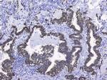 Cytokeratin 19 Antibody in Immunohistochemistry (Paraffin) (IHC (P))