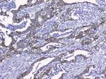 Cytokeratin 19 Antibody in Immunohistochemistry (Paraffin) (IHC (P))