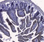 Cytokeratin 19 Antibody in Immunohistochemistry (Paraffin) (IHC (P))