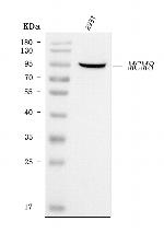 MCM8 Antibody in Western Blot (WB)