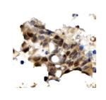 OGT Antibody in Immunohistochemistry (Paraffin) (IHC (P))