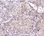 Alix Antibody in Immunohistochemistry (Paraffin) (IHC (P))