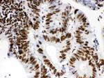 RbAp48 Antibody in Immunohistochemistry (Paraffin) (IHC (P))