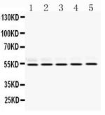 RbAp48 Antibody in Western Blot (WB)