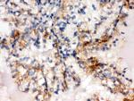 SULT2A1 Antibody in Immunohistochemistry (Paraffin) (IHC (P))