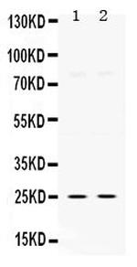 TK1 Antibody in Western Blot (WB)