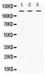 UNC5C Antibody in Western Blot (WB)