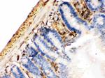 Galectin 1 Antibody in Immunohistochemistry (Paraffin) (IHC (P))