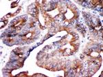 SPTLC1 Antibody in Immunohistochemistry (Paraffin) (IHC (P))