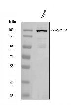 TRPM4 Antibody in Western Blot (WB)