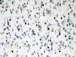 MEF2A Antibody in Immunohistochemistry (Paraffin) (IHC (P))