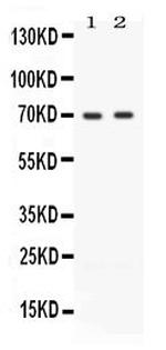 Zap-70 Antibody in Western Blot (WB)