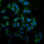 TPL2 Antibody in Immunocytochemistry (ICC/IF)