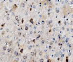 TPL2 Antibody in Immunohistochemistry (Paraffin) (IHC (P))