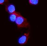 ACVR2A Antibody in Immunocytochemistry (ICC/IF)