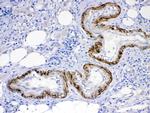 ACVR2A Antibody in Immunohistochemistry (Paraffin) (IHC (P))