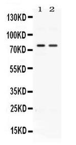 ACVR2A Antibody in Western Blot (WB)