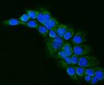 ALDH1B1 Antibody in Immunocytochemistry (ICC/IF)