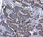 ALDH1B1 Antibody in Immunohistochemistry (Paraffin) (IHC (P))