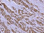 ALDH1B1 Antibody in Immunohistochemistry (Paraffin) (IHC (P))