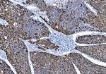 ALDH1B1 Antibody in Immunohistochemistry (Paraffin) (IHC (P))