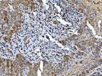 ALDH1B1 Antibody in Immunohistochemistry (Paraffin) (IHC (P))