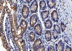 ALDH1B1 Antibody in Immunohistochemistry (Paraffin) (IHC (P))