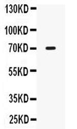 IL12RB1 Antibody in Western Blot (WB)