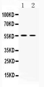 VAChT Antibody in Western Blot (WB)