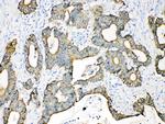 Cytokeratin 18 Antibody in Immunohistochemistry (Paraffin) (IHC (P))