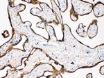 Cytokeratin 18 Antibody in Immunohistochemistry (Paraffin) (IHC (P))