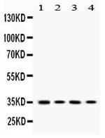 MC1R Antibody in Western Blot (WB)