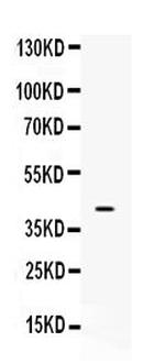 MC2R Antibody in Western Blot (WB)