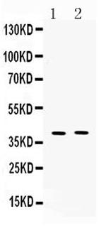 MC3R Antibody in Western Blot (WB)