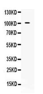 NAA15 Antibody in Western Blot (WB)