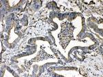 beta-2 Microglobulin Antibody in Immunohistochemistry (Paraffin) (IHC (P))