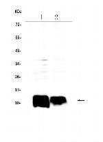 beta-2 Microglobulin Antibody in Western Blot (WB)