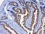 Cytokeratin 8 Antibody in Immunohistochemistry (Paraffin) (IHC (P))