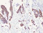 Cytokeratin 8 Antibody in Immunohistochemistry (Paraffin) (IHC (P))