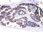 Cytokeratin 8 Antibody in Immunohistochemistry (Paraffin) (IHC (P))