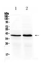 OTC Antibody in Western Blot (WB)