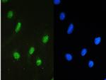 STAT1 Antibody in Immunocytochemistry (ICC/IF)