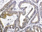 TIMP4 Antibody in Immunohistochemistry (Paraffin) (IHC (P))