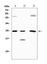 TIMP4 Antibody in Western Blot (WB)