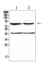 TSH Receptor Antibody in Western Blot (WB)