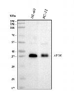 ATOH1 Antibody in Western Blot (WB)