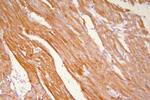 HSP20 Antibody in Immunohistochemistry (Paraffin) (IHC (P))